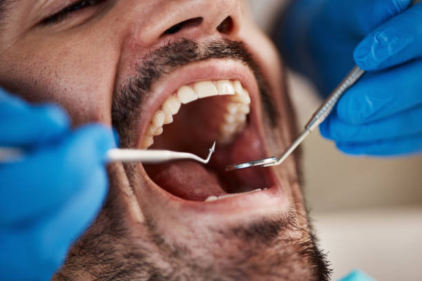 Best Orthodontic Emergency Dentist in Prunedale, CA